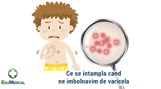 preul vascular de varicoza permis cu vene varicoase care